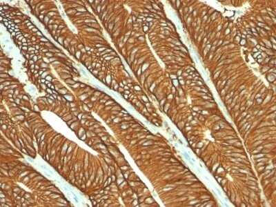 Immunohistochemistry-Paraffin: EpCAM/TROP1 Antibody (MOC-31) - Azide and BSA Free [NBP2-47875]