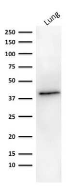 Western Blot: EpCAM/TROP1 Antibody (MOC-31)Azide and BSA Free [NBP2-47875]