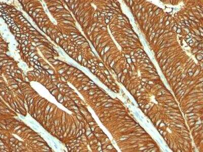 Immunohistochemistry-Paraffin: EpCAM/TROP1 Antibody (MOC-31) - IHC-Prediluted [NBP2-48287]