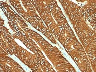 Immunohistochemistry-Paraffin: EpCAM/TROP1 Antibody (MOC-31) [NBP2-44640]