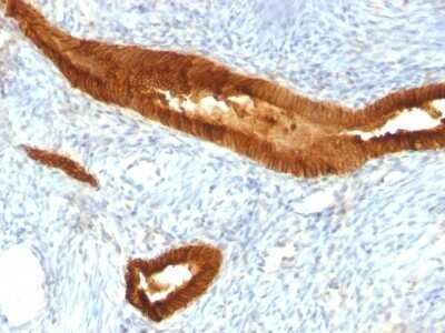 Immunohistochemistry-Paraffin: EpCAM/TROP1 Antibody (MOC-31) [NBP2-44640]