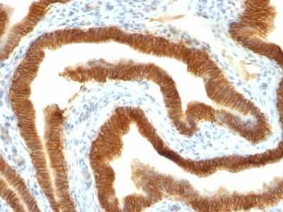 Immunohistochemistry-Paraffin: EpCAM/TROP1 Antibody (MOC-31) [NBP2-44640]