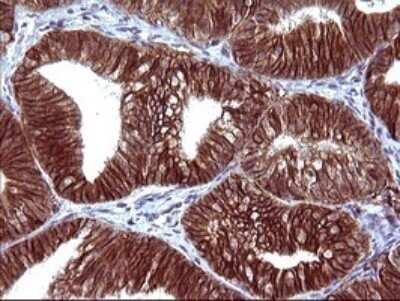 Immunohistochemistry: EpCAM/TROP1 Antibody (OTI1H9) - Azide and BSA Free [NBP2-71194]