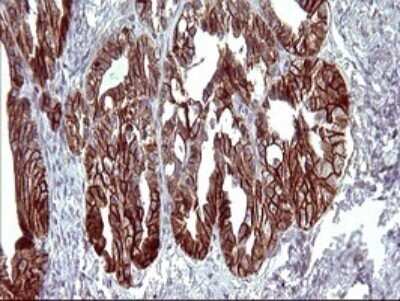 Immunohistochemistry: EpCAM/TROP1 Antibody (OTI1H9) - Azide and BSA Free [NBP2-71194]