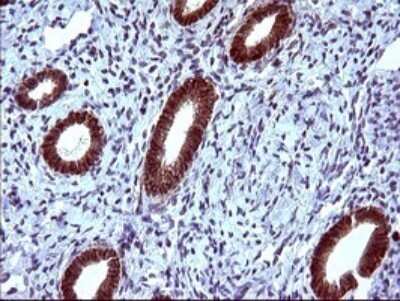 Immunohistochemistry: EpCAM/TROP1 Antibody (OTI1H9) - Azide and BSA Free [NBP2-71194]