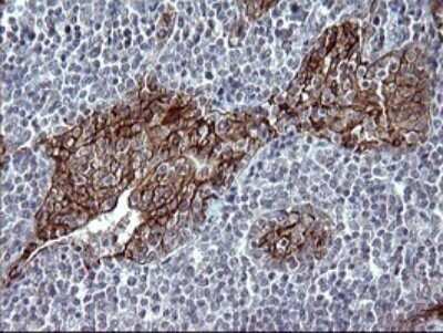 Immunohistochemistry: EpCAM/TROP1 Antibody (OTI1H9) - Azide and BSA Free [NBP2-71194]