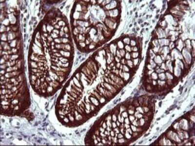 Immunohistochemistry: EpCAM/TROP1 Antibody (OTI1H9) [NBP2-45448]