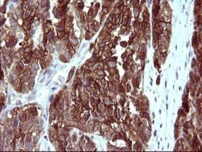 Immunohistochemistry: EpCAM/TROP1 Antibody (OTI1H9) [NBP2-45448]