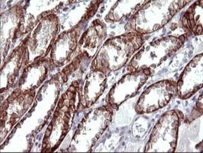 Immunohistochemistry: EpCAM/TROP1 Antibody (OTI1H9) [NBP2-45448]
