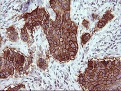 Immunohistochemistry: EpCAM/TROP1 Antibody (OTI1H9) [NBP2-45448]