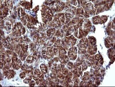Immunohistochemistry: EpCAM/TROP1 Antibody (OTI1H9) [NBP2-45448]