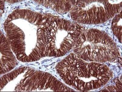 Immunohistochemistry: EpCAM/TROP1 Antibody (OTI1H9) [NBP2-45448]