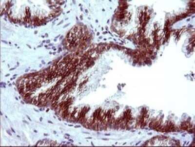 Immunohistochemistry: EpCAM/TROP1 Antibody (OTI1H9) [NBP2-45448]
