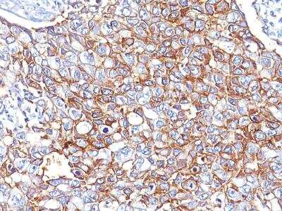 Immunohistochemistry-Paraffin: EpCAM/TROP1 Antibody (PAN-EpCAM (Cocktail)) - IHC-Prediluted [NBP2-48290]