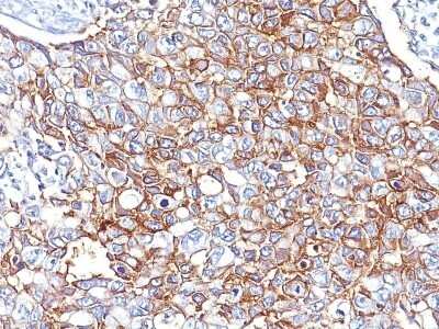 Immunohistochemistry-Paraffin: EpCAM/TROP1 Antibody (PAN-EpCAM (Cocktail)) [NBP2-44645]