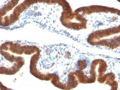 Immunohistochemistry-Paraffin: EpCAM/TROP1 Antibody (SPM134) - (ECD) - Azide and BSA Free [NBP2-34398]
