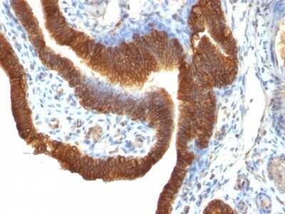 Immunohistochemistry-Paraffin: EpCAM/TROP1 Antibody (SPM491) - (ECD) [NBP2-44637]