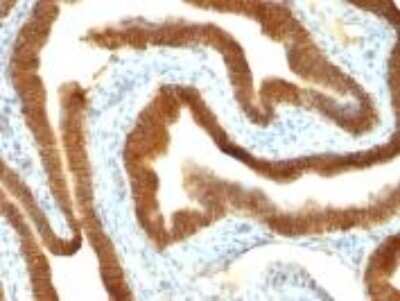 Immunohistochemistry-Paraffin: EpCAM/TROP1 Antibody (VU-1D9) [NBP2-33051]