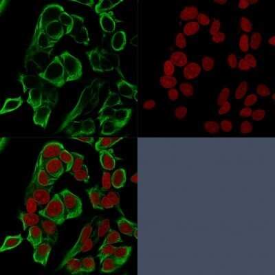 Immunocytochemistry/ Immunofluorescence: EpCAM/TROP1 Antibody (rMOC-31) - Azide and BSA Free [NBP2-54521]