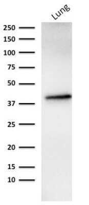 Western Blot: EpCAM/TROP1 Antibody (rMOC-31)Azide and BSA Free [NBP2-54521]