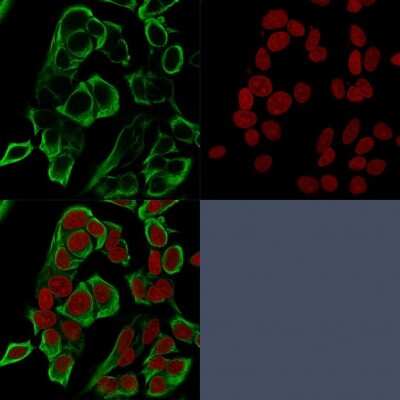 Immunocytochemistry/ Immunofluorescence: EpCAM/TROP1 Antibody (rMOC-31) [NBP2-53329]