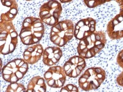 Immunohistochemistry-Paraffin: EpCAM/TROP1 Antibody (rMOC-31) [NBP2-53329]