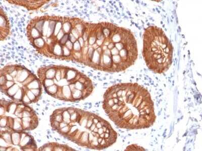 Immunohistochemistry-Paraffin: EpCAM/TROP1 Antibody (rVU-1D9) - (ECD) - Azide and BSA Free [NBP2-54408]