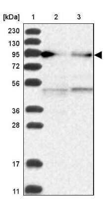 Western Blot: Epac2 Antibody [NBP2-32009]