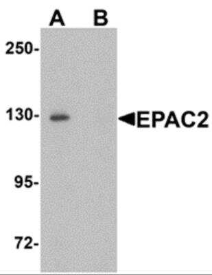 Western Blot: Epac2 AntibodyBSA Free [NBP2-82089]