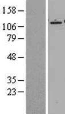 Western Blot: Epac2 Overexpression Lysate [NBL1-15153]