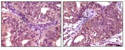 Immunohistochemistry-Paraffin: EphA1 Antibody (5D2) - BSA Free [NB100-1763]