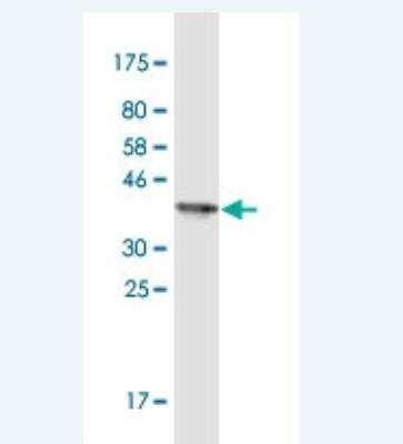 Western Blot: EphA1 Antibody (8D4) [H00002041-M14-100ug]