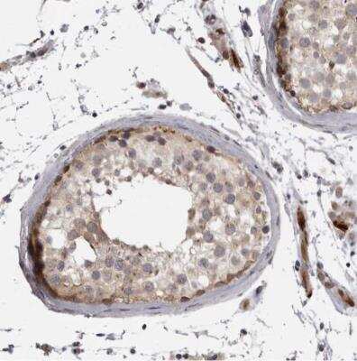 Immunohistochemistry-Paraffin: EphA10 Antibody [NBP1-83677]