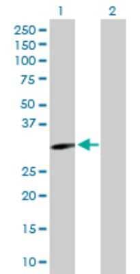 Western Blot: EphA10 Antibody [H00284656-D01P]