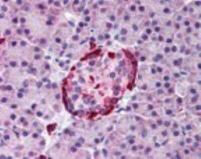 Immunohistochemistry-Paraffin: EphA2 Antibody [NBP2-24489]