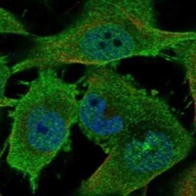 Immunocytochemistry/ Immunofluorescence: EphA3 Antibody [NBP3-17708]