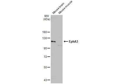 Western Blot: EphA3 Antibody [NBP2-16346]