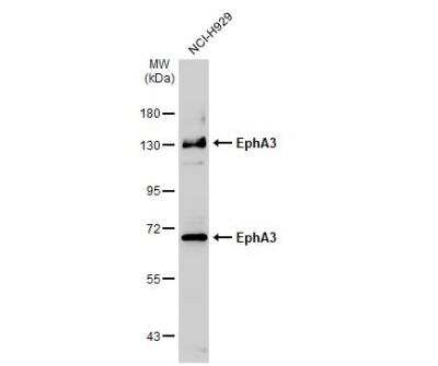 Western Blot: EphA3 Antibody [NBP2-16346]