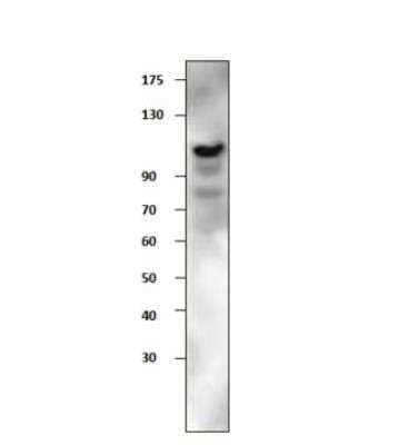 Western Blot: EphA3 Antibody [NBP3-12465]