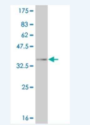 Western Blot: EphA4 Antibody (5A9) [H00002043-M03]