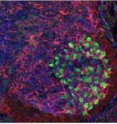 Immunohistochemistry: EphA4 Antibody [NBP1-98363]