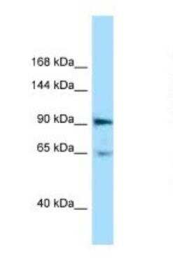 Western Blot: EphA4 Antibody [NBP1-98363]