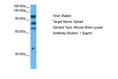 Western Blot: EphA4 Antibody [NBP1-98363]