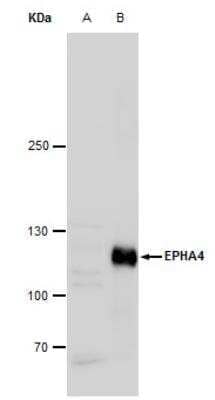 Western Blot: EphA4 Antibody [NBP2-16347]