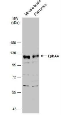 Western Blot: EphA4 Antibody [NBP2-16347]