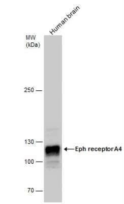 Western Blot: EphA4 Antibody [NBP2-16347]