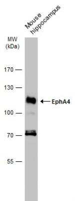 Western Blot: EphA4 Antibody [NBP2-16347]