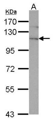Western Blot: EphA4 Antibody [NBP2-16348]