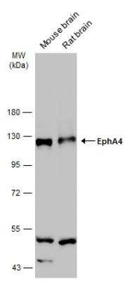 Western Blot: EphA4 Antibody [NBP2-16348]