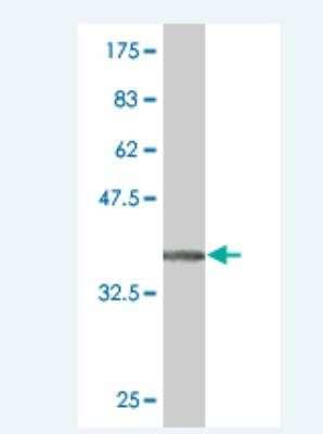 Western Blot: EphA5 Antibody (5C3) [H00002044-M02]